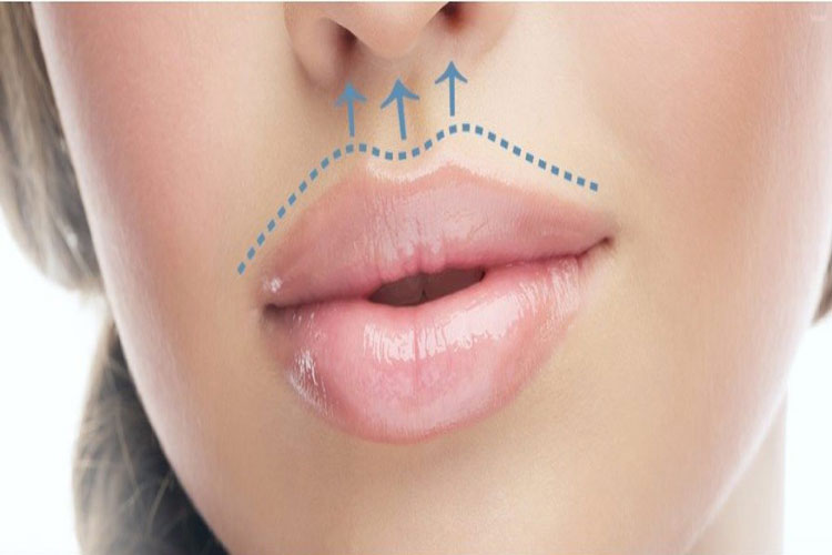 مزایای سانترال لب چیست؟