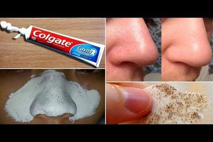 آیا از بین بردن لک صورت با خمیردندان واقعاً مؤثر است؟