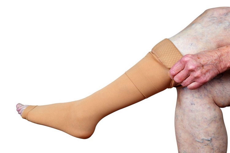آیا می‌توان با جوراب واریس خوابید؟ 