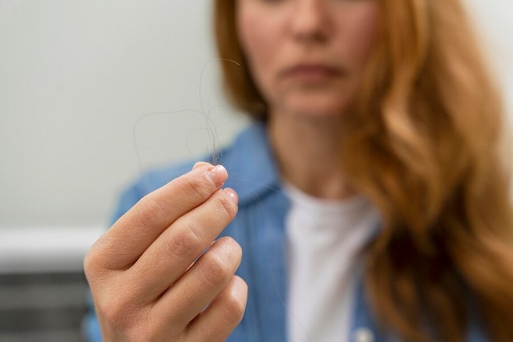 چرا ریزش مو در زنان شایع است؟