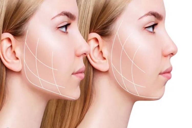 آیا زاویه سازی فک با هایفوتراپی دردناک است؟