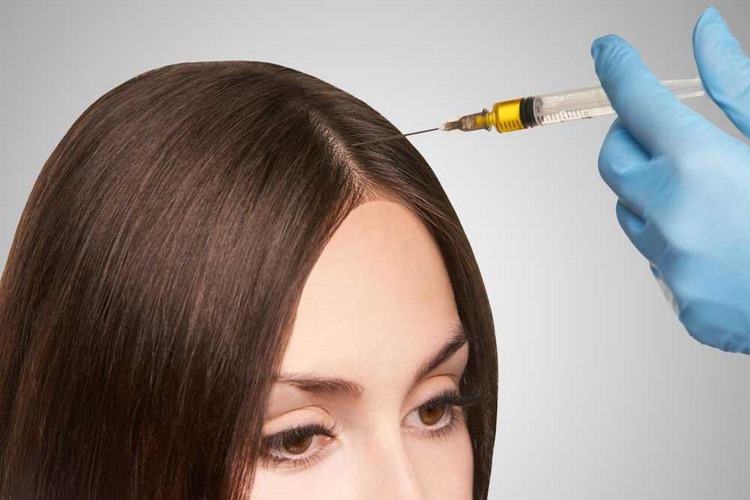 پی آر پی مو چیست و چگونه عمل می‌کند؟