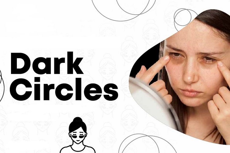 چه زمانی برای سیاهی دور چشم باید به پزشک مراجعه کرد؟