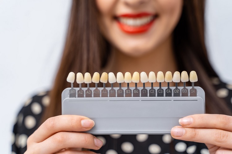 چگونه از عوارض لمینت دندان پیشگیری کنیم؟