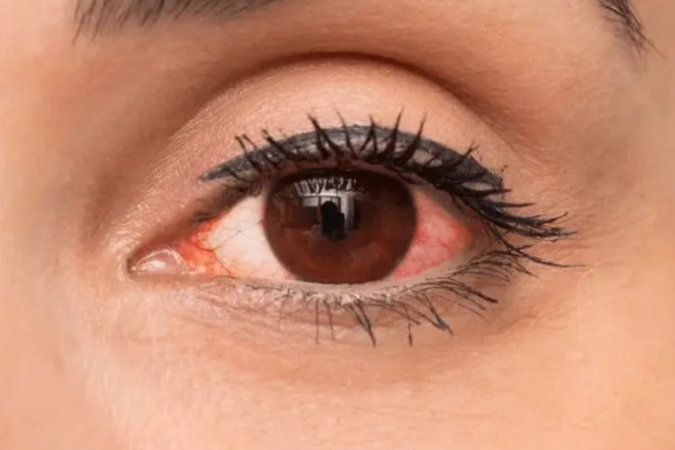 چگونه از عوارض تاتو خط چشم جلوگیری کنیم؟