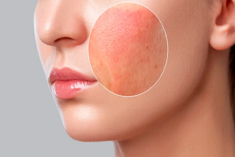 عوارض استفاده از لوازم آرایش تاریخ گذشته