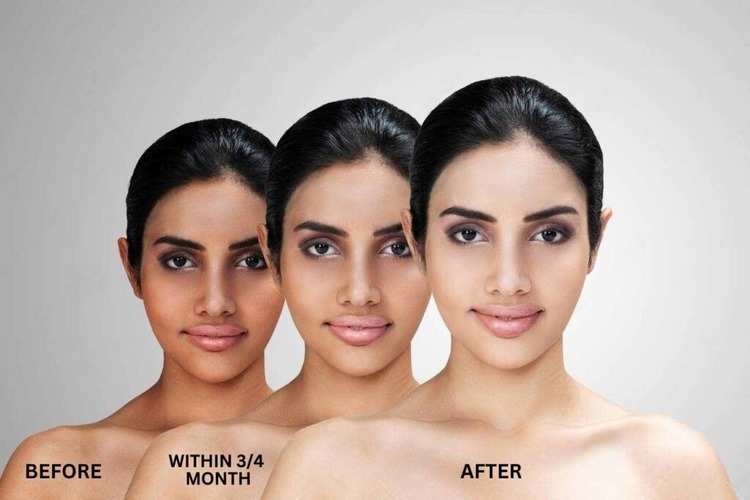 چه کسانی گزینه مناسبی برای لیزر روشن‌کننده هستند؟