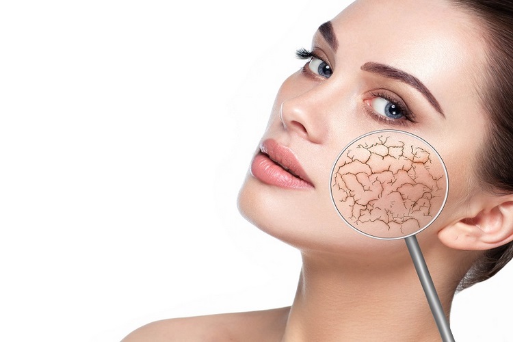 چرا پوست خشک نیاز به کرم ضدآفتاب مخصوص دارد؟