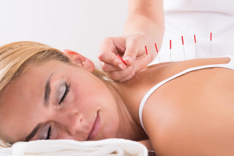 طب سوزنی برای دیسک کمر