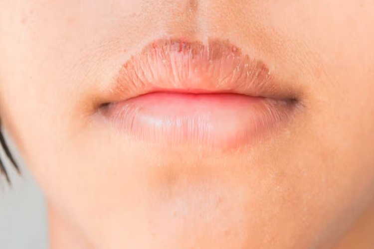 عوارض و مشکلات ترک خوردن لب زیر رژ
