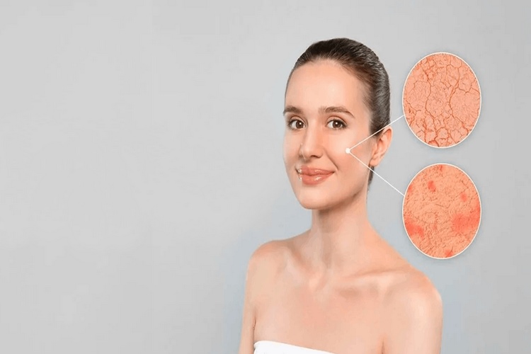 چگونه آبرسان را به درستی روی پوست خشک استفاده کنیم؟