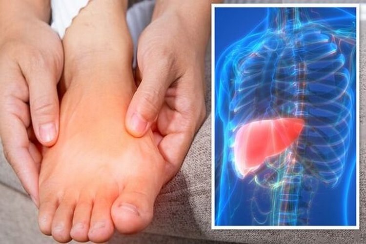 عوامل خطر و دلایل ابتلا به کبد چرب در زنان
