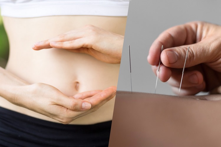 عوارض و نکات احتیاطی طب سوزنی برای لاغری
