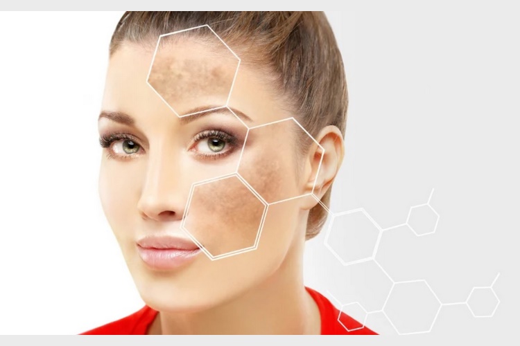 رایج‌ترین عوارض تزریق ژل به صورت چیست؟