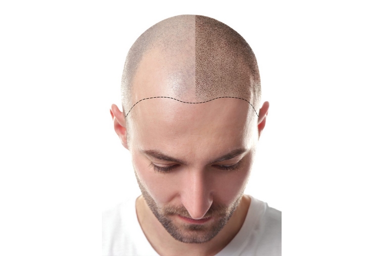 اسکالپ چیست و چه کاربردی دارد؟
