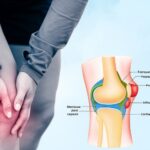 سینوویت زانو چیست؟