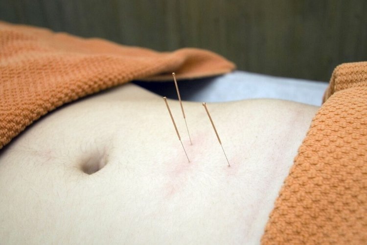 طب سوزنی همراه با چه روش‌های دیگری موثرتر است؟