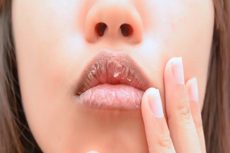 چرا لب‌ها زیر رژ ترک می‌خورند؟