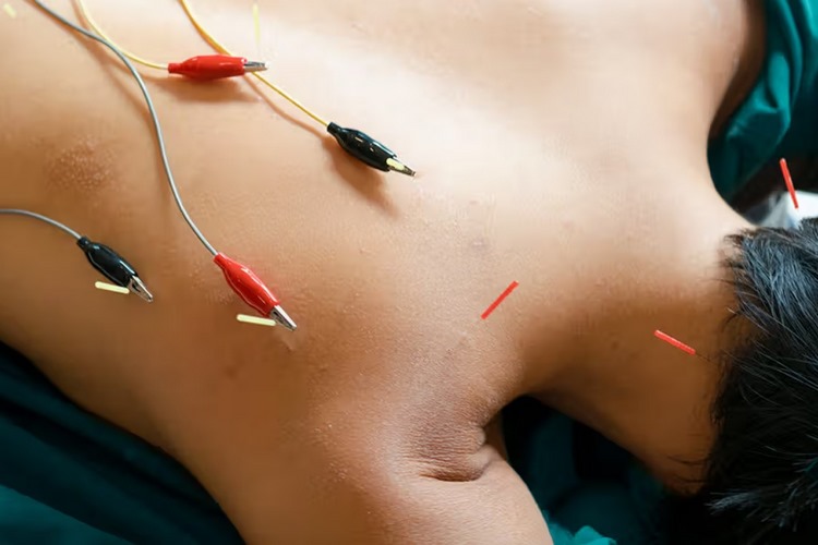 طب سوزنی در کنترل بیماری‌های قلبی و عروقی
