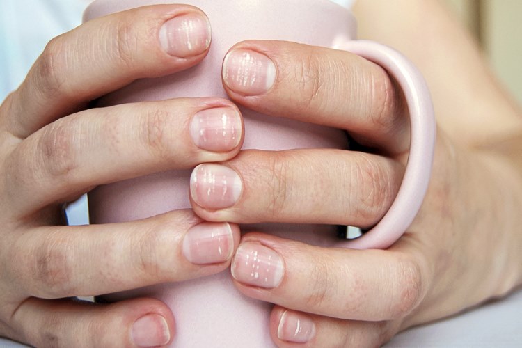 نکات مهم برای پیشگیری از عفونت ناخن دست