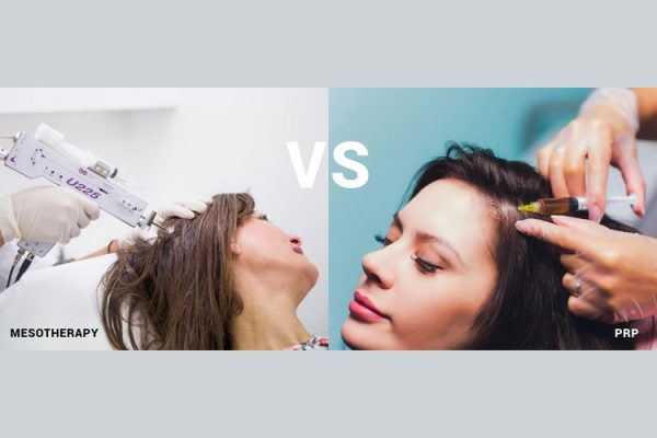 پی آر پی مو بهتر است یا مزوتراپی