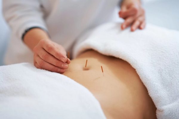 آیا طب سوزنی روشی مؤثر برای لاغری شکم و پهلو است؟