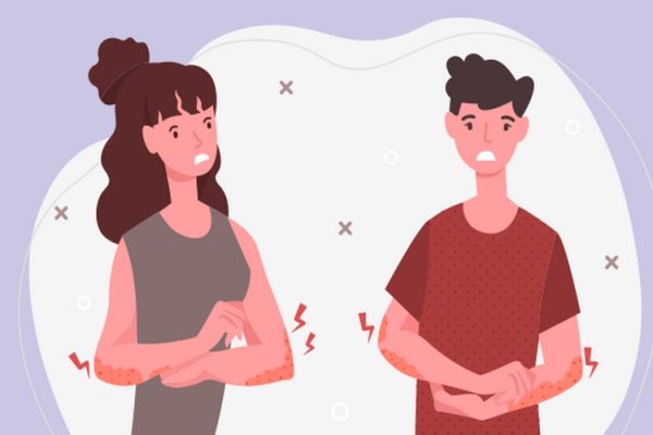 بهترین دارو برای خارش بدن