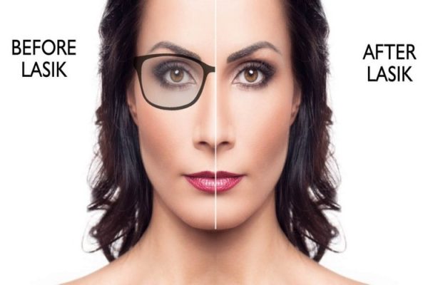 عمل لیزیک چشم برای چه کسانی مناسب است؟